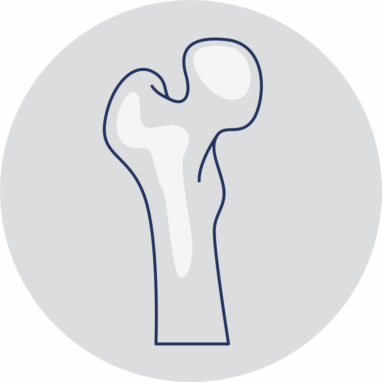 Knochendichtemessung (DXA) | Ihr Rückenzentrum