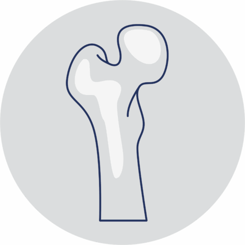 Knochendichtemessung (DXA) | Ihr Rückenzentrum