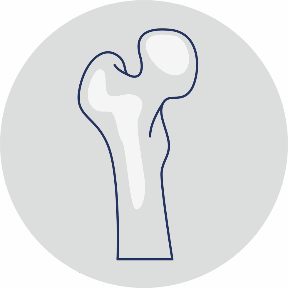 Knochendichtemessung (DXA) | Ihr Rückenzentrum